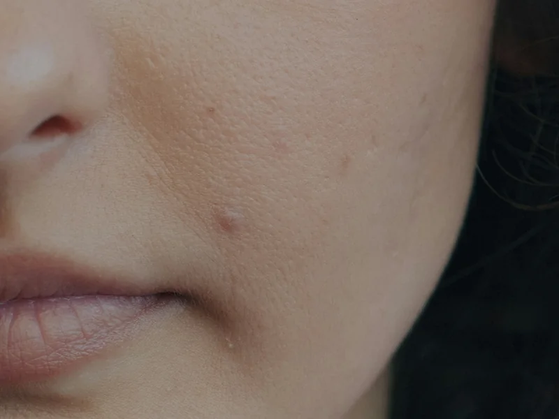 Natural skin texture on the cheek, close up